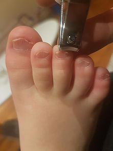 cutting baby toenails